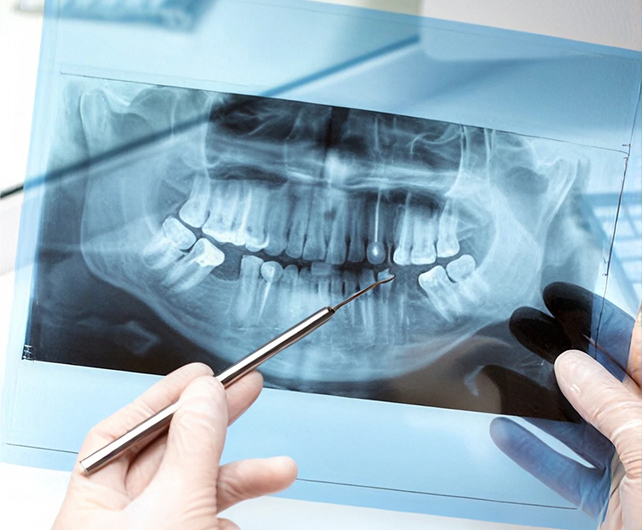 Dental-it-support-in-Savannah Dental IT Support in Marietta